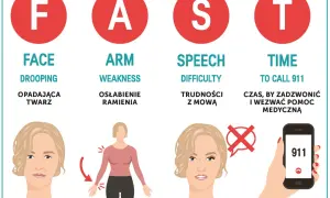 Objawy zawału mózgu: opadająca twarz, osłabienie ramienia, trudności z mową. Czas to życie, dzwoń 911.