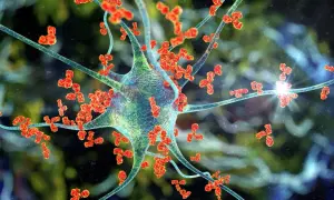 Komórka nerwowa atakowana przez przeciwciała, ilustracja procesu autoimmunologicznego zapalenia mózgu.