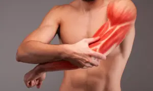 Mężczyzna trzyma rękę, ukazując czerwone, podświetlone mięśnie ramienia. Może to symbolizować miopatię objawy, ból lub zapalenie mięśni.