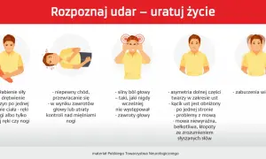 Objawy udaru: osłabienie kończyn, problemy z chodzeniem, silny ból głowy, asymetria twarzy, zaburzenia widzenia. Poznaj rodzaje udarów i ratuj życie.