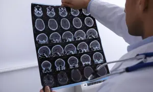 Lekarz analizuje tomografię komputerową głowy, szukając oznak krwiaka mózgu. Obraz pokazuje przekroje mózgu w różnych płaszczyznach.