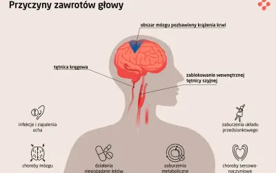 Ilustracja przedstawia przyczyny zawrotów głowy: blokadę tętnicy szyjnej, problemy z krążeniem mózgu, infekcje ucha, choroby mózgu, działania niepożądane leków, zaburzenia metaboliczne, zaburzenia układu przedsionkowego i choroby sercowo-naczyniowe.
