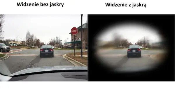 Widzenie bez jaskry pokazuje pełny obraz drogi, podczas gdy widzenie z jaskrą ogranicza pole widzenia, rozmazując krawędzie.