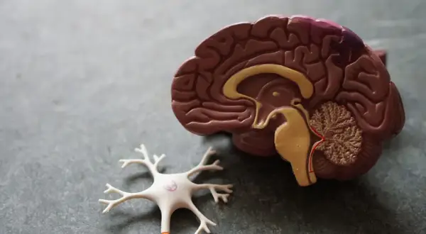 Model mózgu i neuron. Udar mózgu może prowadzić do zaburzeń percepcji, takich jak urojenia po udarze mózgu.