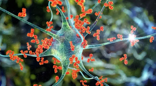 Komórka nerwowa atakowana przez przeciwciała, ilustracja procesu autoimmunologicznego zapalenia mózgu.