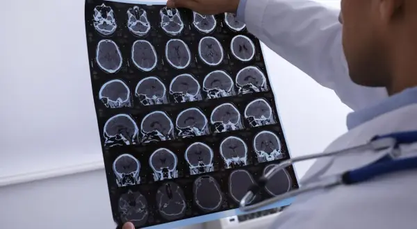 Lekarz analizuje tomografię komputerową głowy, szukając oznak krwiaka mózgu. Obraz pokazuje przekroje mózgu w różnych płaszczyznach.