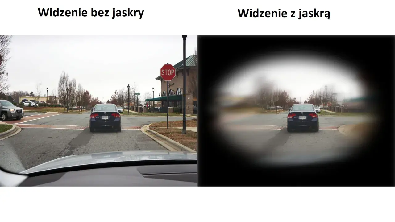 Widzenie bez jaskry pokazuje pełny obraz drogi, podczas gdy widzenie z jaskrą ogranicza pole widzenia, rozmazując krawędzie.