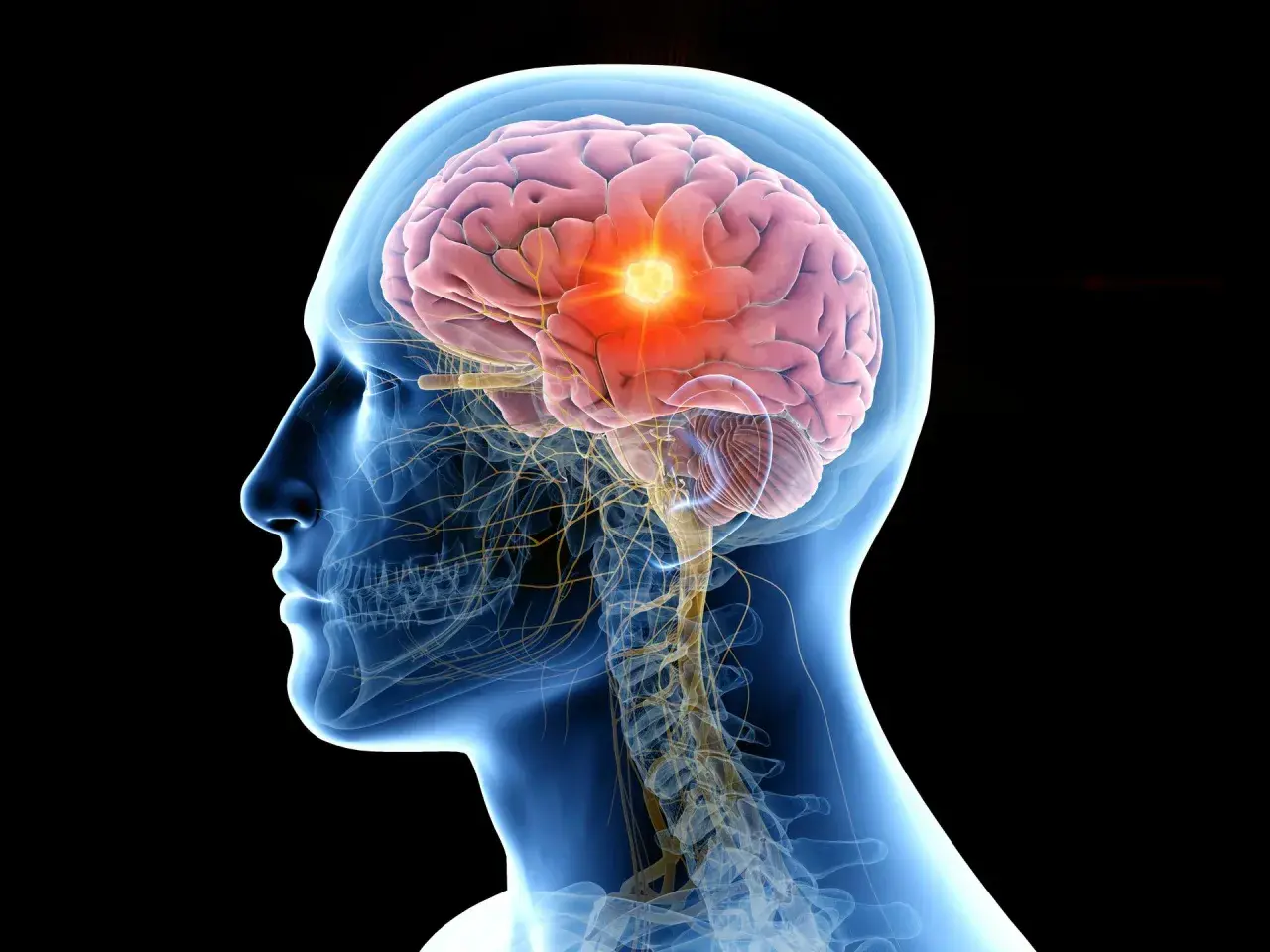 Ilustracja mózgu z podświetlonym obszarem, symbolizującym choroby neurologiczne.