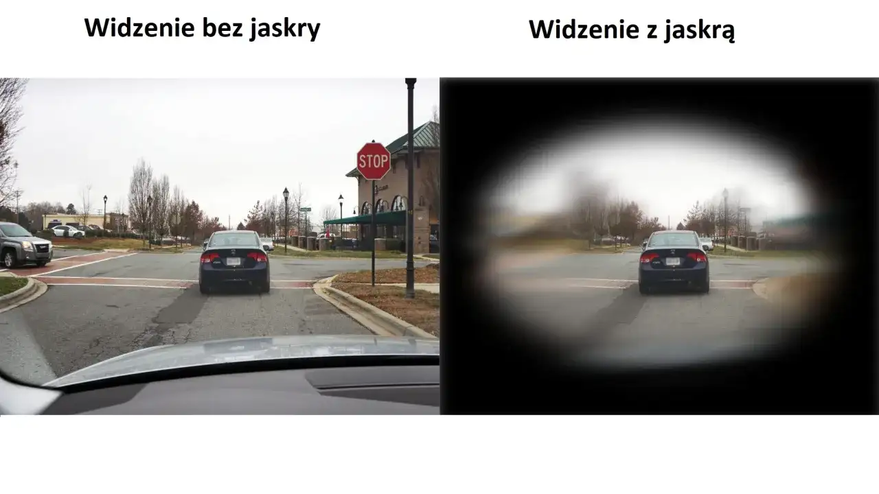 Widzenie bez jaskry pokazuje pełny obraz drogi, podczas gdy widzenie z jaskrą ogranicza pole widzenia, rozmazując krawędzie.