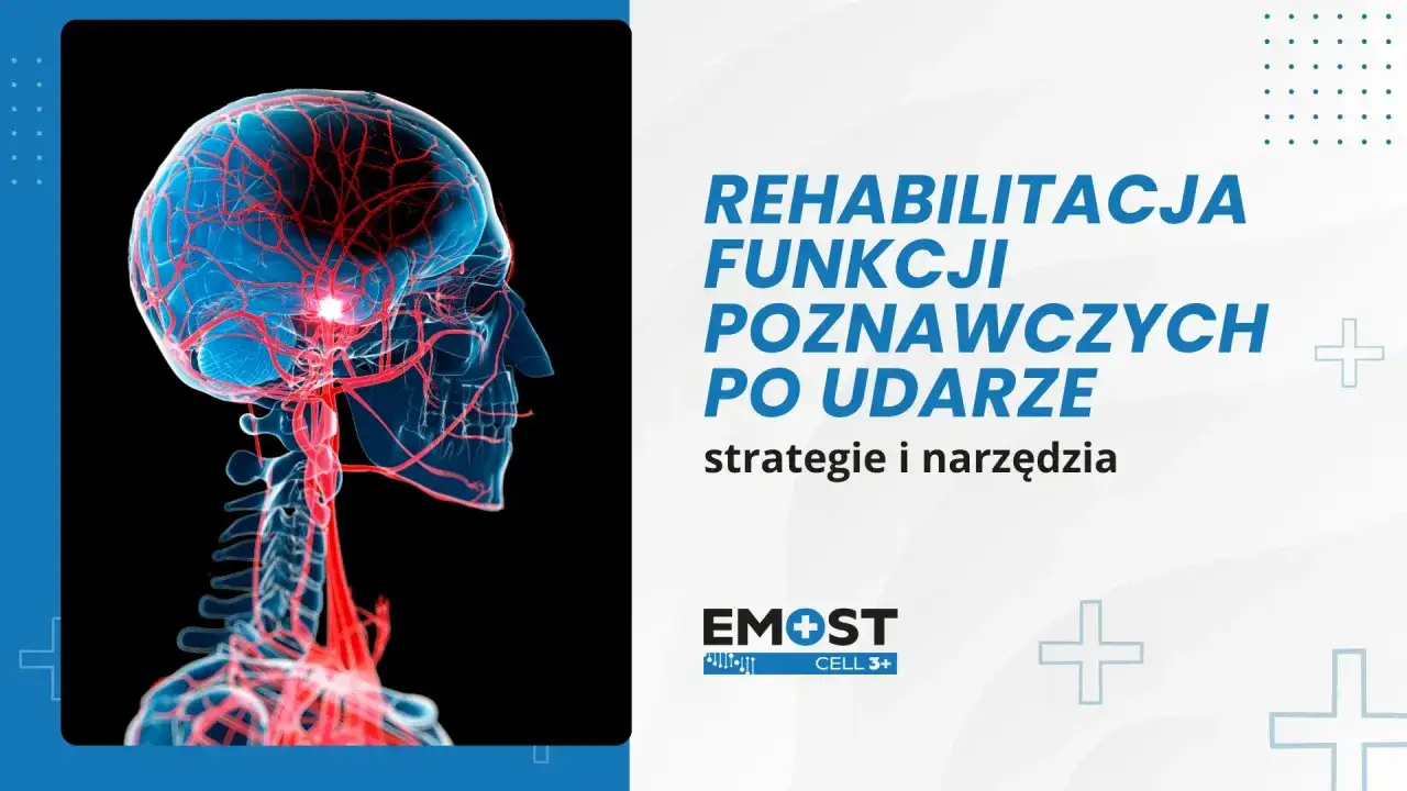 Rehabilitacja funkcji poznawczych po udarze. Jak ćwiczyć pamięć? Grafika przedstawia mózg z naczyniami krwionośnymi.