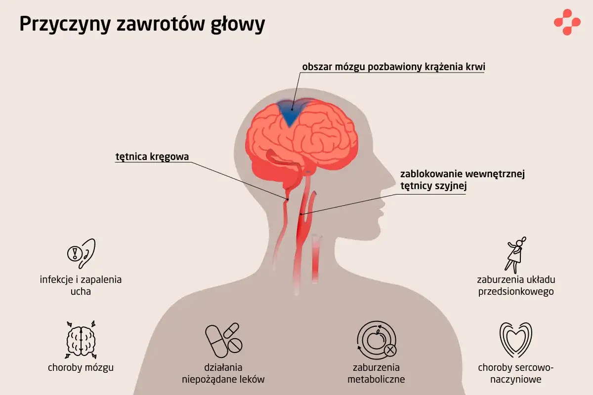 Ilustracja pokazuje przyczyny zawrotów głowy, w tym problemy z krążeniem mózgowym, infekcje ucha, choroby mózgu, zaburzenia metaboliczne i sercowo-naczyniowe.