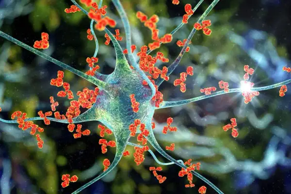 Komórka nerwowa atakowana przez przeciwciała, ilustracja procesu autoimmunologicznego zapalenia mózgu.