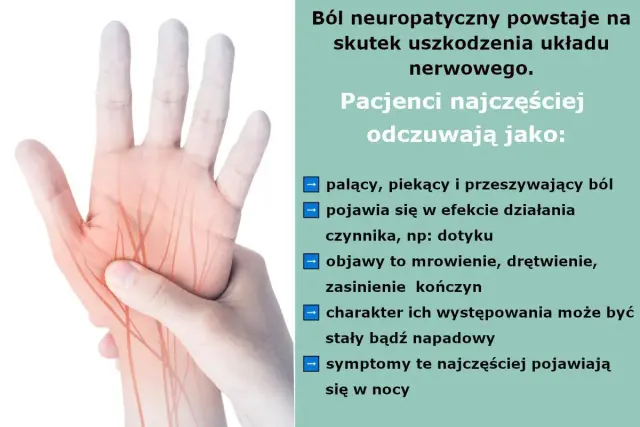 Dłoń z zaznaczonymi nerwami, symbolizującymi ból neuropatyczny. Odczuwany jako palący, piekący, z mrowieniem i drętwieniem.